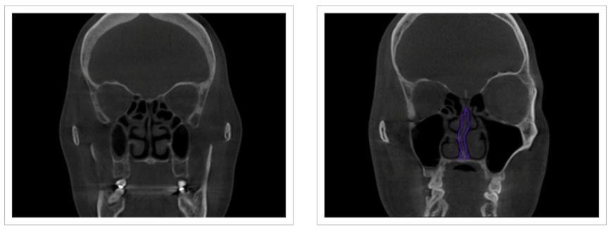 삼성드림이비인후과