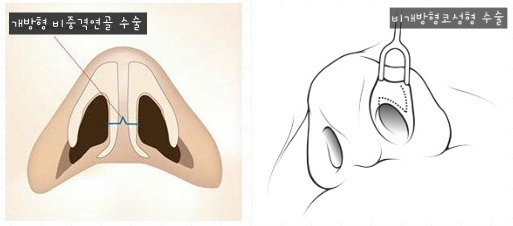 삼성드림이비인후과