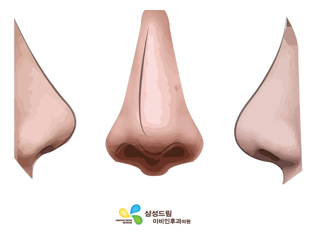 삼성드림이비인후과