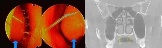 삼성드림이비인후과